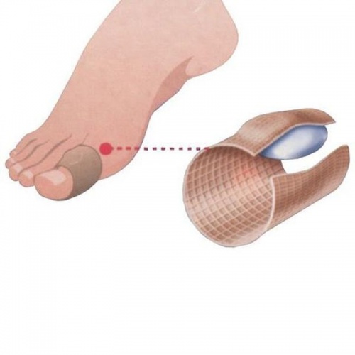 JuraGel Elastic Toe Sheath