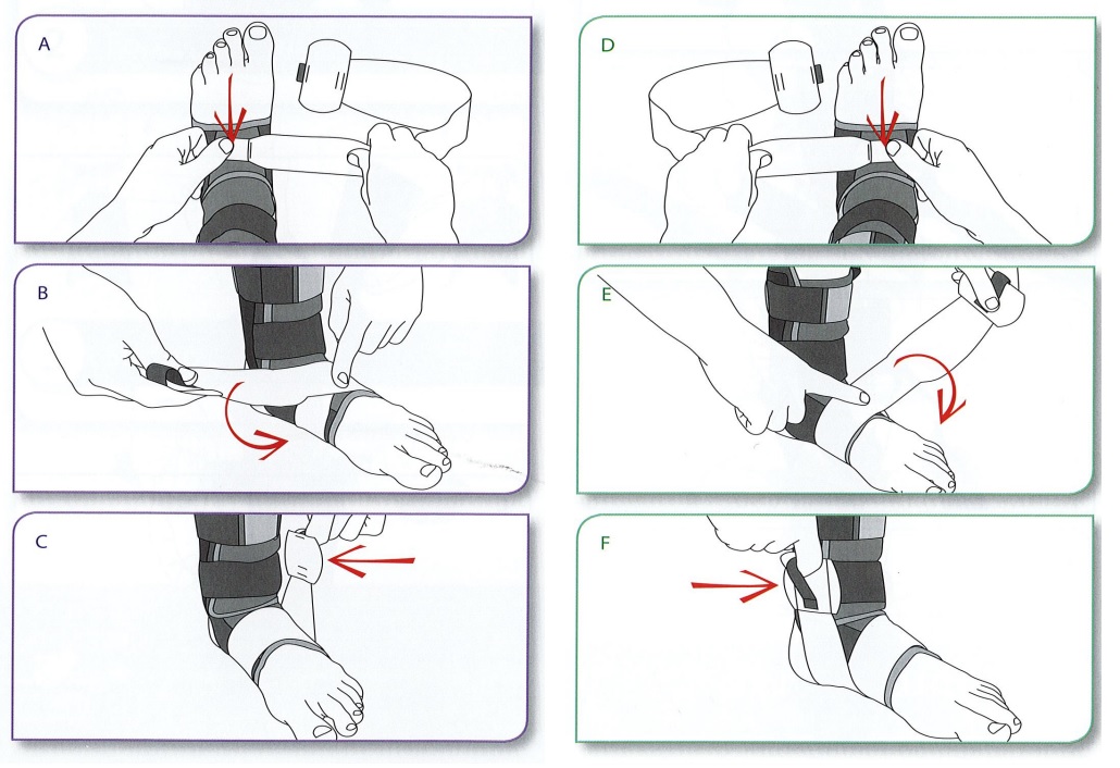 Fitting Your BioSkin FootLok Strap - Diagram