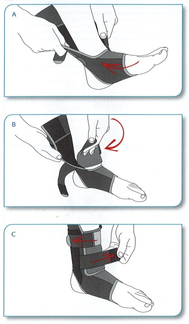 Fitting Your BioSkin Undersleeve - Diagram